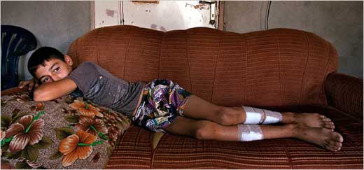 An Injured Lebanese Boy - Israeli Terrorism